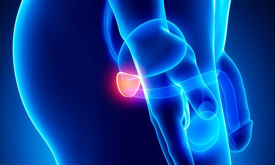 Entzündung vum Prostates mat Prostatitis