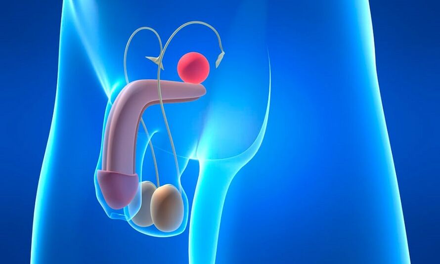 edema vum Prostates mat Prostatitis
